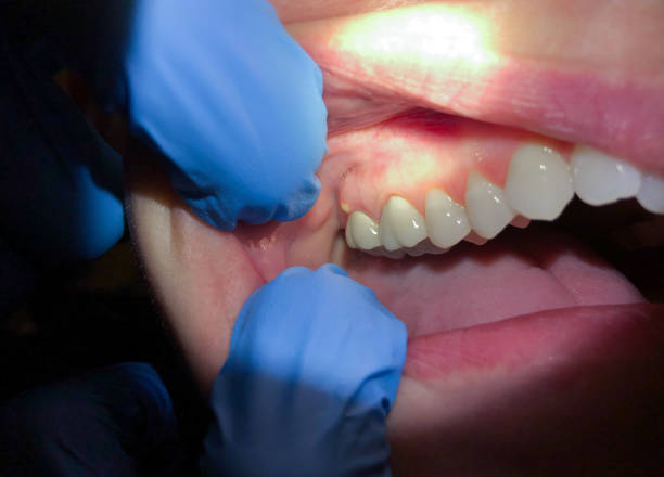 Best Mobile Emergency Dentist in Patton Village, TX